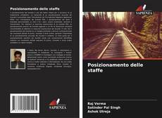 Copertina di Posizionamento delle staffe