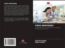 Bookcover of CIRES DENTAIRES