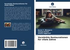 Copertina di Verstärkte Restaurationen für vitale Zähne