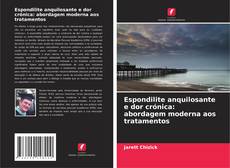 Borítókép a  Espondilite anquilosante e dor crónica: abordagem moderna aos tratamentos - hoz
