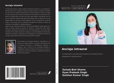 Copertina di Anclaje intraoral