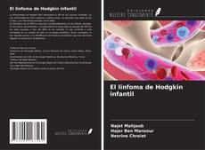 Copertina di El linfoma de Hodgkin infantil