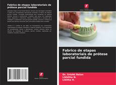 Copertina di Fabrico de etapas laboratoriais de prótese parcial fundida