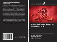 Copertina di Tumores metastásicos en la cavidad oral