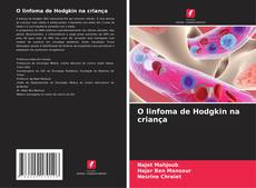 Copertina di O linfoma de Hodgkin na criança