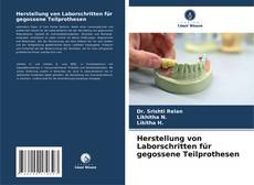 Обложка Herstellung von Laborschritten für gegossene Teilprothesen