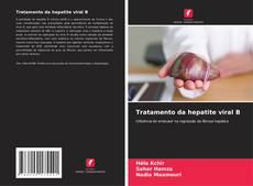 Bookcover of Tratamento da hepatite viral B