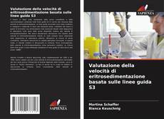 Bookcover of Valutazione della velocità di eritrosedimentazione basata sulle linee guida S3
