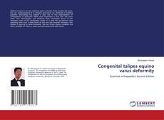 Capa do livro de Congenital talipes equino varus deformity 