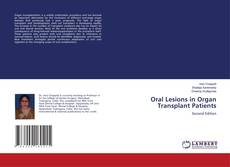 Buchcover von Oral Lesions in Organ Transplant Patients