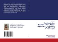 Sulphadoxine Pyrimethamine (SP) in P.falciparum malaria in West Bengal的封面
