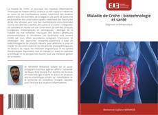Couverture de Maladie de Crohn : biotechnologie et santé