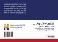 Bookcover of Laser Transmyocardial Revascularization and Laser Vascular Anastomosis