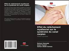 Bookcover of Effet du relâchement myofascial sur le syndrome du canal carpien
