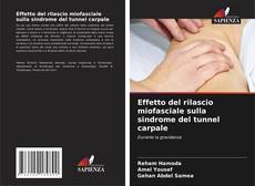 Buchcover von Effetto del rilascio miofasciale sulla sindrome del tunnel carpale