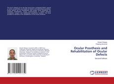 Bookcover of Ocular Prosthesis and Rehabilitation of Ocular Defects