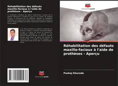 Couverture de Réhabilitation des défauts maxillo-faciaux à l'aide de prothèses - Aperçu