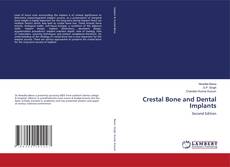Couverture de Crestal Bone and Dental Implants