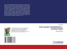 Bookcover of Full mouth rehabilitation - attrited teeth