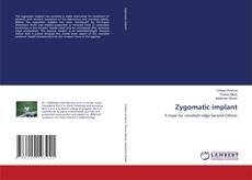 Buchcover von Zygomatic implant
