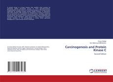 Copertina di Carcinogenesis and Protein Kinase C