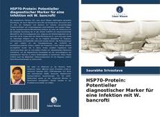HSP70-Protein: Potentieller diagnostischer Marker für eine Infektion mit W. bancrofti的封面