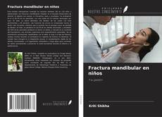 Buchcover von Fractura mandibular en niños