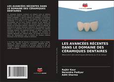 Couverture de LES AVANCÉES RÉCENTES DANS LE DOMAINE DES CÉRAMIQUES DENTAIRES