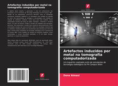 Artefactos induzidos por metal na tomografia computadorizada的封面
