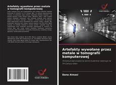 Buchcover von Artefakty wywołane przez metale w tomografii komputerowej