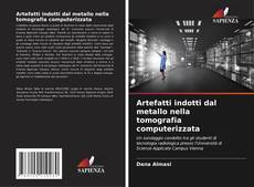 Copertina di Artefatti indotti dal metallo nella tomografia computerizzata