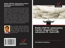 Copertina di Białko HSP70: potencjalny marker diagnostyczny zakażenia W. bancrofti