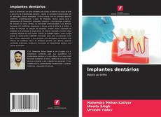 Copertina di Implantes dentários