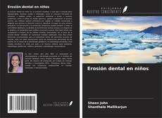 Copertina di Erosión dental en niños
