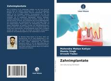 Copertina di Zahnimplantate