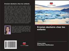 Buchcover von Érosion dentaire chez les enfants