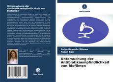 Buchcover von Untersuchung der Antibiotikaempfindlichkeit von Biofilmen