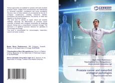 Bookcover of Prostate cancer and comorbid urological pathologies