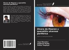 Couverture de Úlcera de Mooren y queratitis ulcerosa periférica