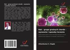 Bookcover of Rak – grupa groźnych chorób – wyzwania i sposoby leczenia