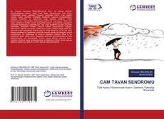 Bookcover of CAM TAVAN SENDROMU