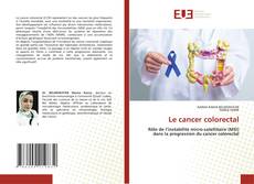 Copertina di Le cancer colorectal