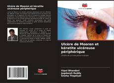 Copertina di Ulcère de Mooren et kératite ulcéreuse périphérique