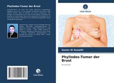 Buchcover von Phyllodes-Tumor der Brust