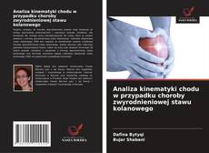 Analiza kinematyki chodu w przypadku choroby zwyrodnieniowej stawu kolanowego的封面