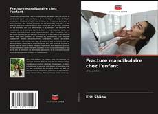 Buchcover von Fracture mandibulaire chez l'enfant