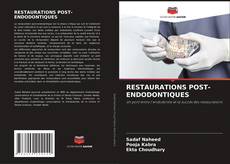 Bookcover of RESTAURATIONS POST-ENDODONTIQUES