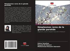 Copertina di Néoplasmes rares de la glande parotide