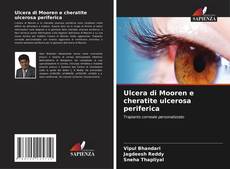 Copertina di Ulcera di Mooren e cheratite ulcerosa periferica