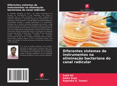 Portada del libro de Diferentes sistemas de instrumentos na eliminação bacteriana do canal radicular
